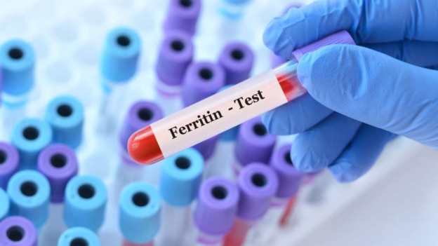 Ferrytyna - badanie